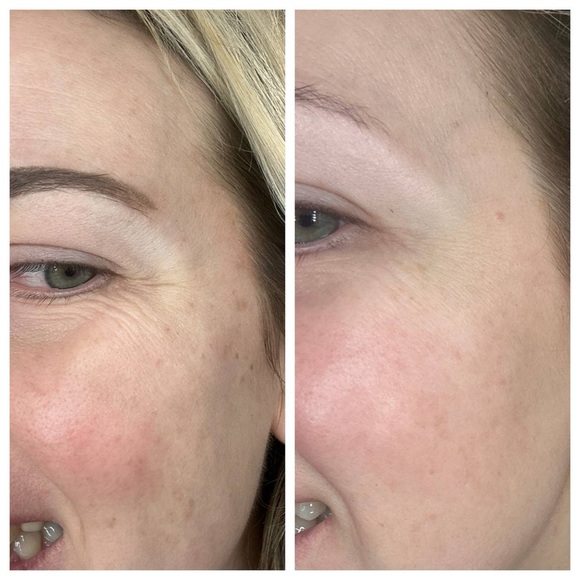 NATURE’S BOTOX IN A BOTTLE - Picture 2 of 9